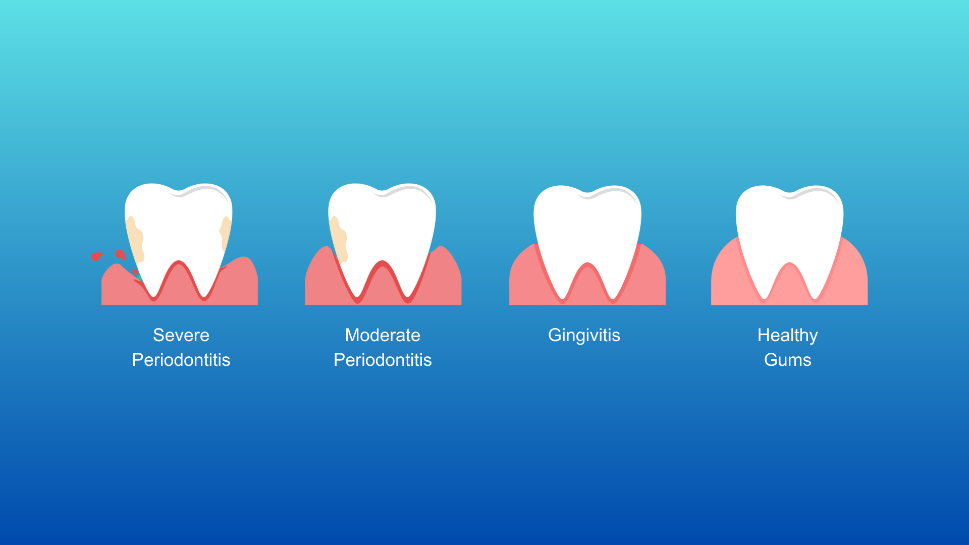 Our Approach to Gum Disease Treatment