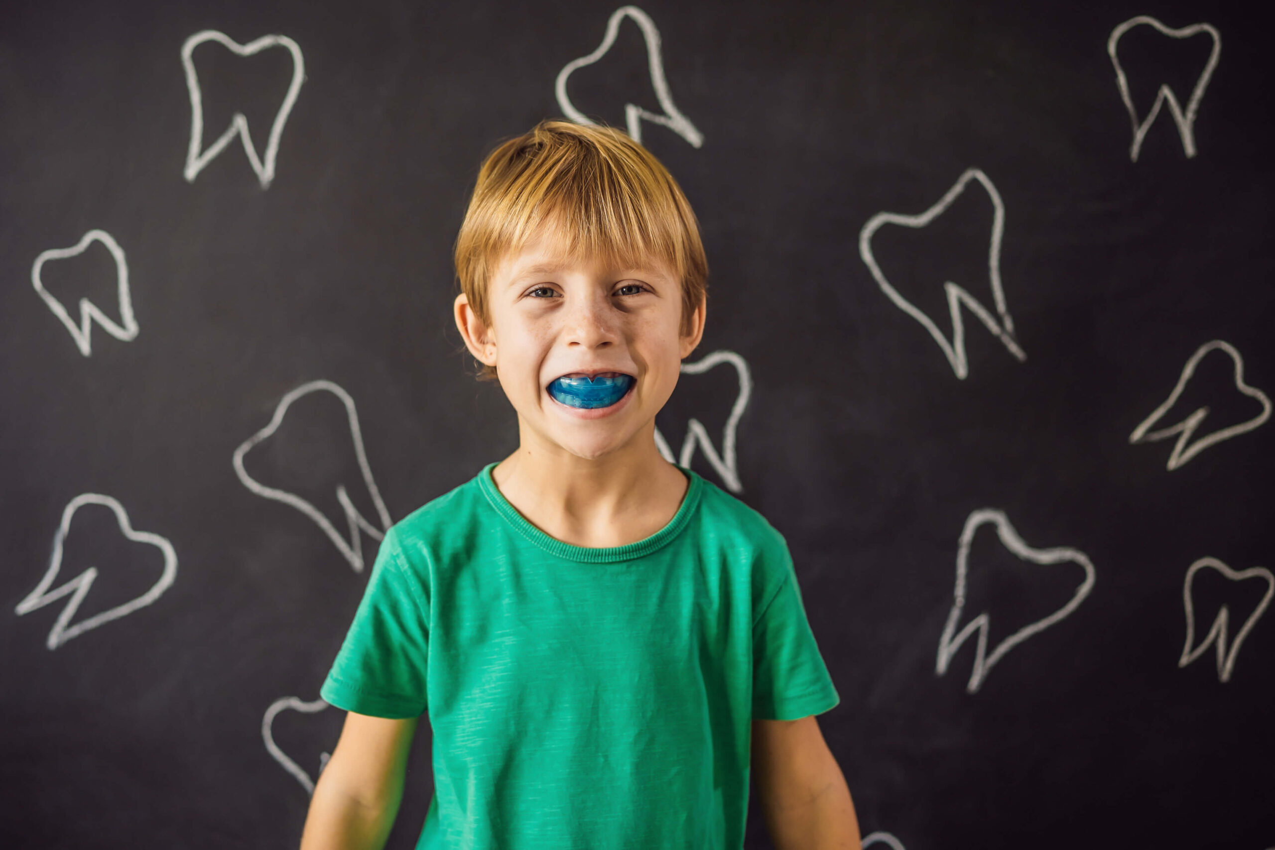 Why Choose Mouthguards Treatment?