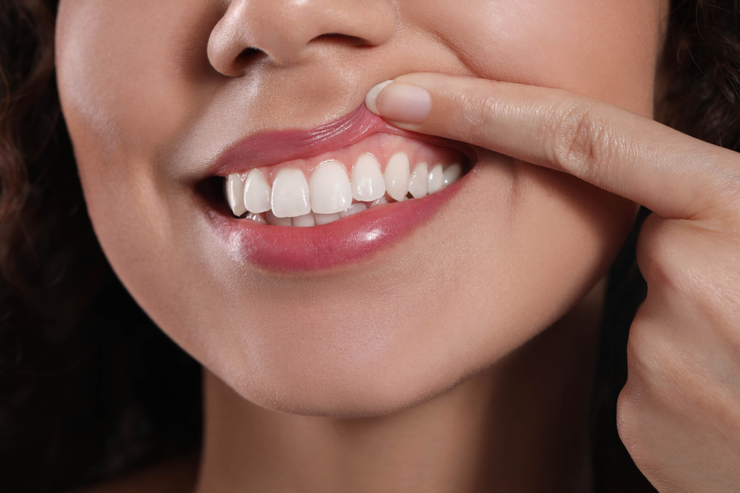 Why Choose Gum Disease Treatment?