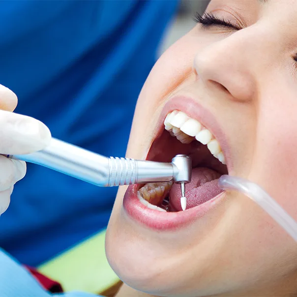 Signs You Might Need a Dental Cleaning Appointment